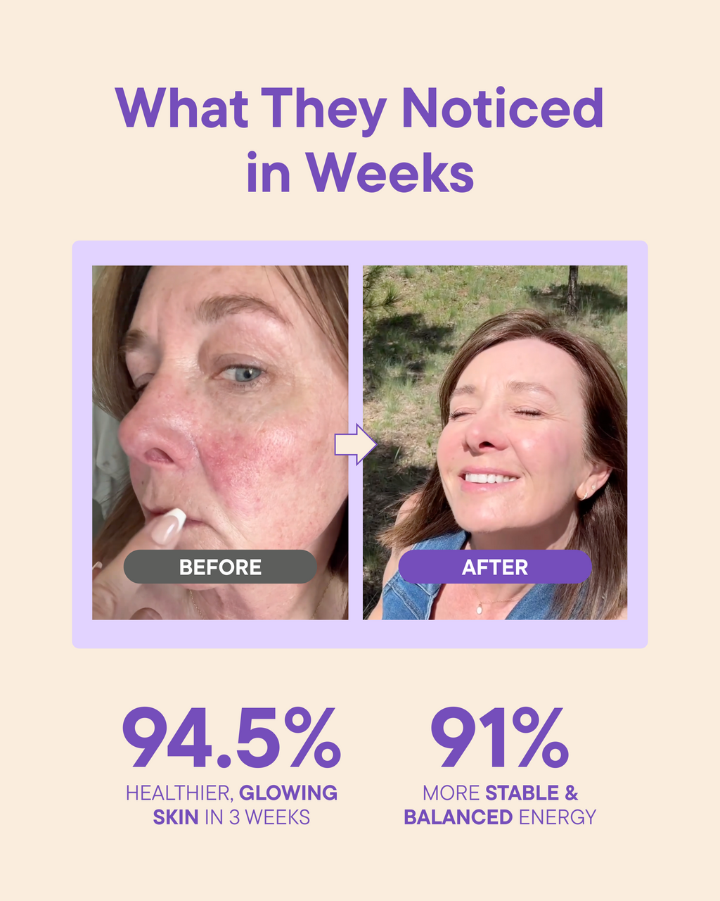 Before-and-after skin results graphic for anti-aging gummies
