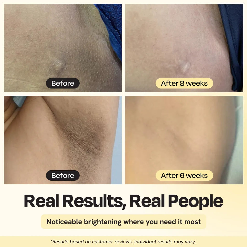 Skin brightening before-and-after close-up collage with labeled panels