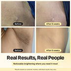 Skin brightening before-and-after close-up collage with labeled panels