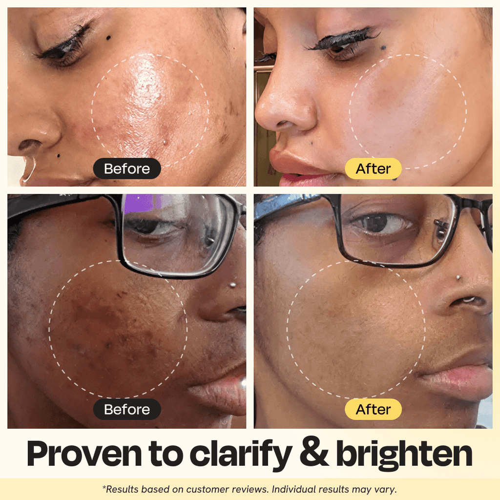 Vitamin C clay mask before-and-after results on face, with dotted circles