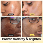 Vitamin C clay mask before-and-after results on face, with dotted circles