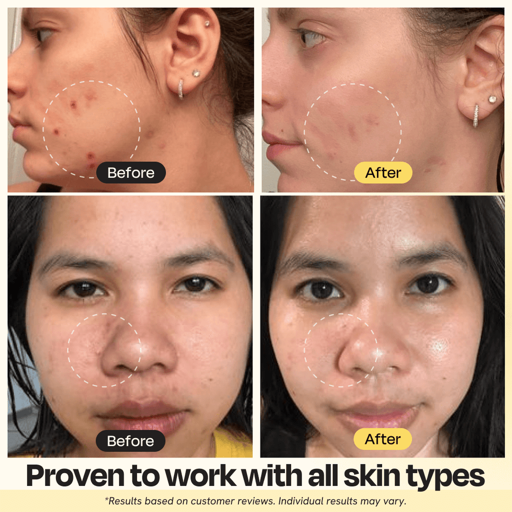 Vitamin C clay mask before-and-after results on face, with dotted circles