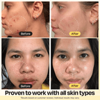 Vitamin C clay mask before-and-after results on face, with dotted circles