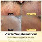 Skin before-and-after results from clarifying brightening cleanser