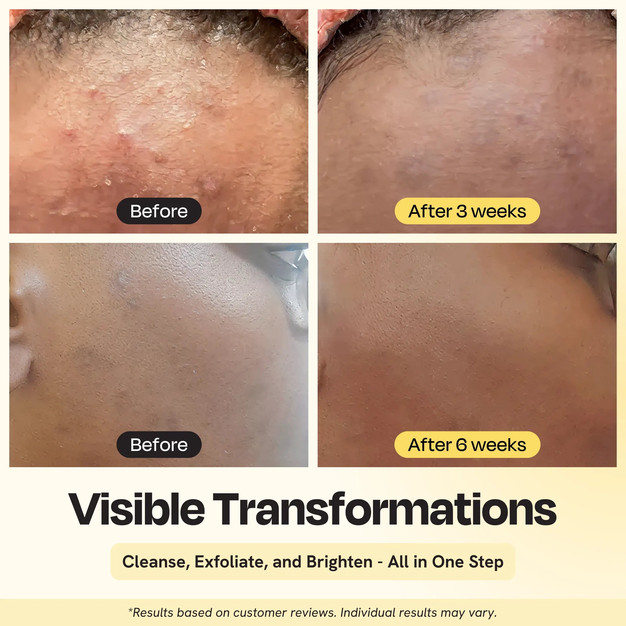 Skin before-and-after results from clarifying brightening cleanser