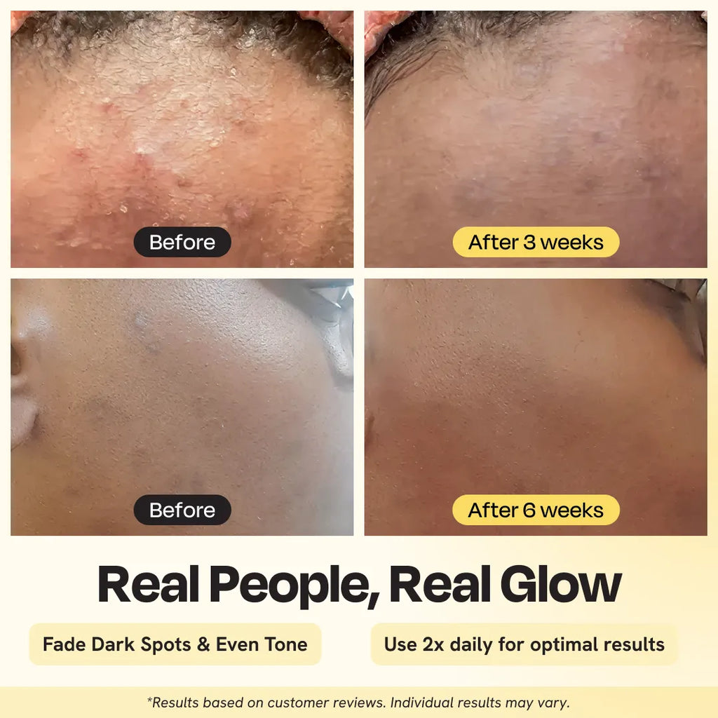 Skin before-and-after swatches showing reduced dark spots and even tone.
