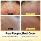 Skin before-and-after swatches showing reduced dark spots and even tone.
