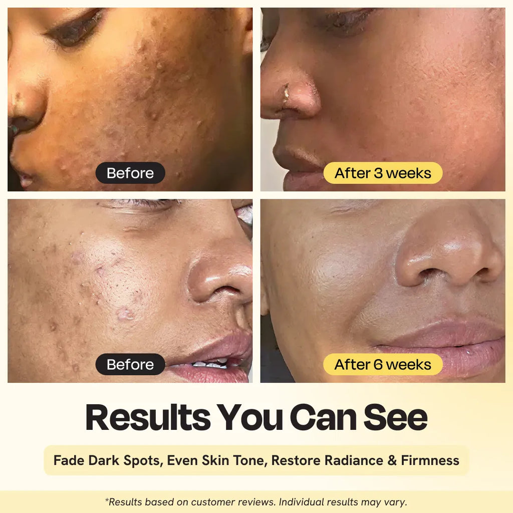 Superactive Serum before-and-after close-up of face skin results