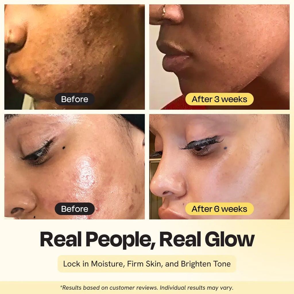 Skin before-and-after panels showing hydrated glow and smoother complexion